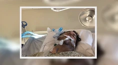 Mladík ignoroval rady rodičov, aby nosil rúško. Otec, ktorého nakazil, bojuje o život