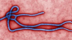 Testy ukázali, že muž, ktorý leží v českej nemocnici, ebolu nemá