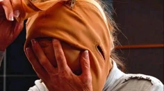 Moment, na ktorý všetci čakali: Znetvorená Dana (28) si strháva masku a šokuje svet!