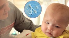 Neuveriteľný medicínsky pokrok: Malému Garrettovi zachránila život 3D tlačiareň