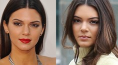 Plastiková rodinka: Aj 18-ročná Kendall sa nechala vylepšiť!