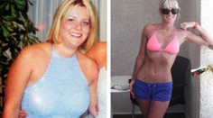 Túžba zbaviť sa veľkých pŕs ju takmer pripravila o život!