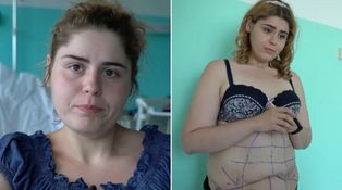 Extrémne premeny – Operácie – Silvia