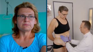 Extrémne premeny – Operácie – Eva