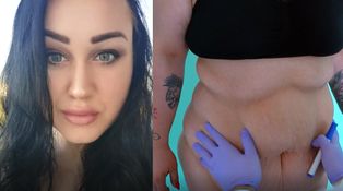 Extrémne premeny - Operácie - Jarka