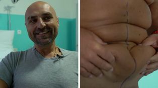 Extrémne premeny – Operácie – Ivan