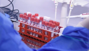 Vedci popísali ďalší následok „dlhého covidu“. Závery výskumu priblížili v štúdii