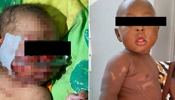 Hrôza, ktorá sa skončila zázrakom. Matka zakopala novonarodené dievčatko, napokon ho zachránili príbuzní
