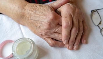 Naša pokožka dostáva v zime zabrať. Odborníčka priblížila, čomu by ste sa určite mali vyhnúť