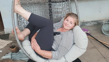 Obrovské nešťastie. Žena spadla tvárou do ohniska, utrpela vážne popáleniny