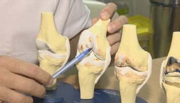 Na návšteve u ortopéda: Tejto chorobe sa nevyhne žiadny človek po 40
