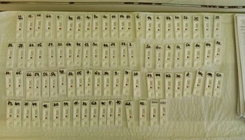 Zisťovali sme, aké sú priebežné výsledky plošného testovania v rizikových zariadeniach