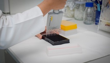 Rakúski a britskí vedci vyvinuli nový test. Ten pomôže včas odhaliť štyri druhy rakoviny