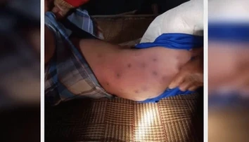Päťročný chlapec zomrel po útoku 30 ôs. Jeho stará mama bojuje o život
