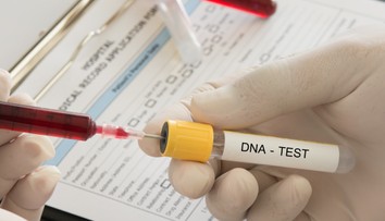 Matka si zo zvedavosti dala urobiť test DNA. Zistila, že 12 rokov vychováva cudzieho syna