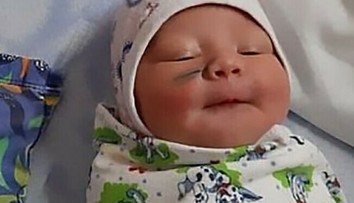 Zhrozená matka zostala po pôrode v šoku: Bábätko malo na líci škaredú jazvu