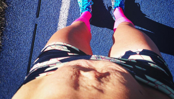 Aj takto vyzerá telo po pôrode. Mamička sa za svoje strie nehanbí