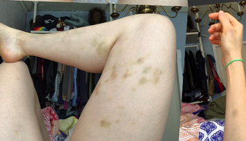 Známa komička odhalila ničivé tajomstvo. S tyranom žila niekoľko mesiacov