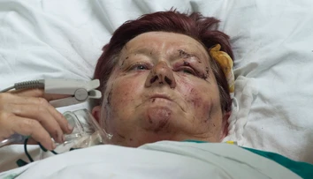 Helena prežila nehodu autobusu, no zostáva v srbskej nemocnici
