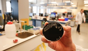 Talianov vystrašila epidémia legionárskej choroby, hlásia aj mŕtvych. Ako je na tom Slovensko?