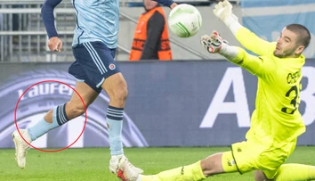 Prečo čoraz viac futbalistov nosí deravé štucne? Vraj im to pomáha pri výkone