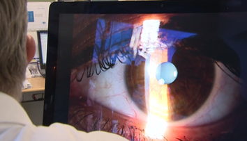 Lekárka, ktorá vyoperovala pacientovi nesprávne oko, spoznala trest