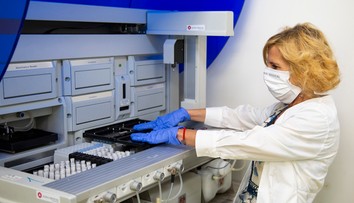 Potešujúca správa. Českí vedci vyvinuli lacný test, ktorý odhalí COVID-19 do hodiny