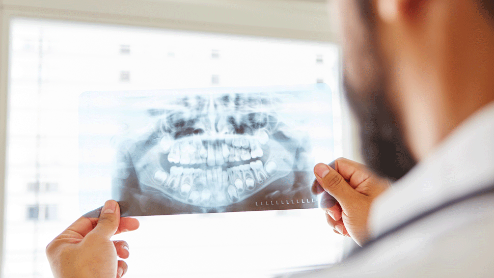 Muž navštívil zubára po 27 rokoch. To, čo prehliadka odhalila, nečakal