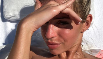 Horúci záber Tatarovej priateľky Lucie. Prsia jej zakryli iba čerešne