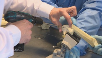 Lekári pri zlomeninách čoraz viac používajú neviditeľné skrutky. Tie zmiznú bez ďalšej operácie