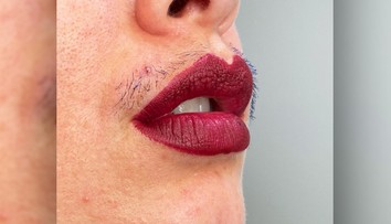 Fotka, ktorá vzbudila ošiaľ. Chĺpky na tvári sú normálne a nemusíte sa za ne hanbiť, tvrdí autorka