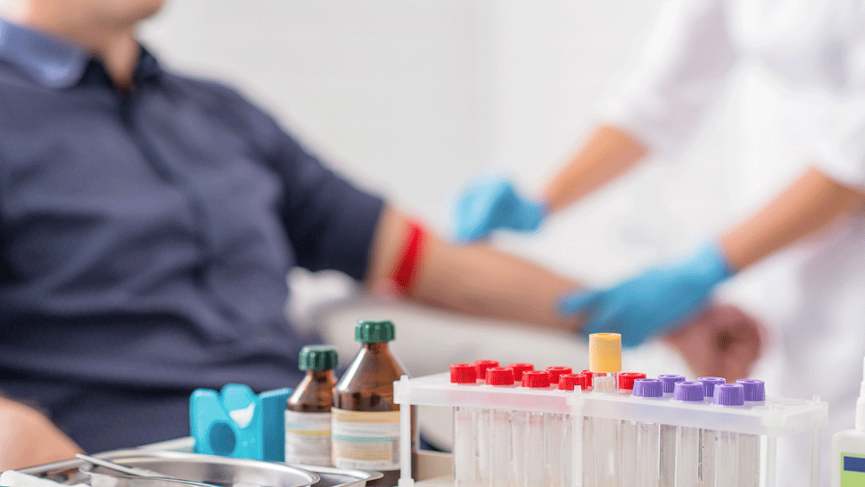 Vedci vyvinuli test, ktorý pacientom s rakovinou povie, či zvládnu chemoterapiu