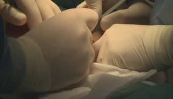 K lekárovi prišla s banálnym problémom. V nemocnici ohluchla a dostala otravu krvi