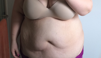 Podarilo sa jej neuveriteľne schudnúť. Snúbenec to neuniesol a svadbu zrušili