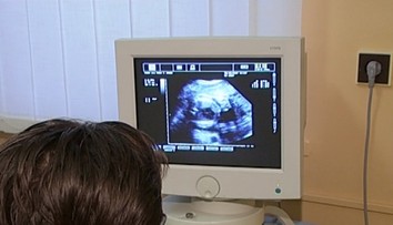 Len 10-ročné dievča z Indie otehotnelo po znásilnení. Súd jej potrat zamietol