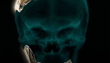 Objavili doteraz neznámy druh predka človeka. Bol podobný neandertálcom