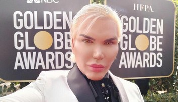 Vrchol nechutnosti: Ľudskému Kenovi (34) odstránili štyri rebrá, odfotil si ich a ukázal