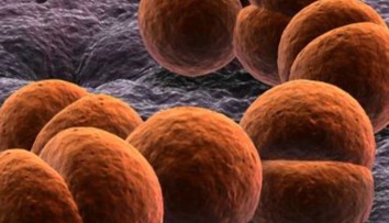 Meningitída zabila ďalšie dieťa. Ako spoznáte príznaky choroby a kde sa môžete nakaziť?