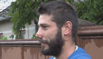 Atillu napadol muž s mačetou. Keď mu strhol kuklu, neveril vlastným očiam