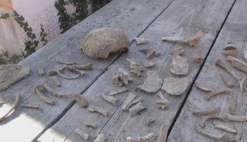 Kopali kanalizáciu, v hline našli viacero ľudských kostí