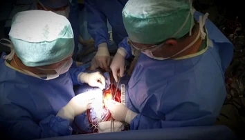 Vo Viedni vykonali prvú transplantáciu pľúc pacientovi s koronavírusom