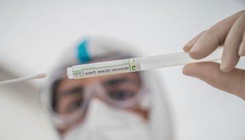 Blížime sa k stropu: Kapacity PCR testov môžeme naplniť už o pár dní