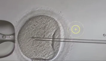 Dávajú nádej párom, ktoré majú problém počať dieťa. Ako vyzerá proces darovania vajíčok?