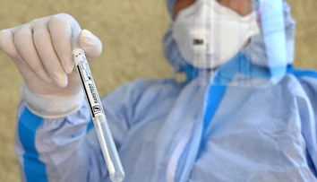 Štátne hmotné rezervy nakúpia pol milióna skríningových testov na COVID-19