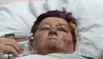 Helena prežila nehodu autobusu, no zostáva v srbskej nemocnici