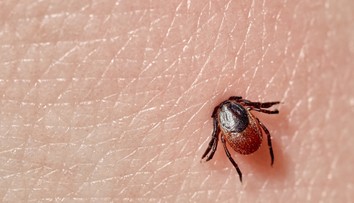 Hrozba v podobe kliešťa. Použiť pri vyberaní masť či olej je chyba