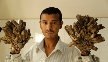 "Stromový muž" chce ukončiť svoje trápenie: Prosí lekárov o radikálne riešenie