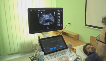 Vyvíjajú najmodernejší ultrazvuk na svete. Na projekte pracujú aj Slováci