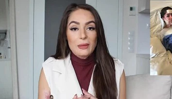 Popálená česká YouTuberka sa odhodlala: Ukázala fotku tesne po nehode