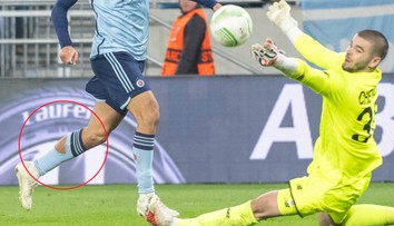 Prečo čoraz viac futbalistov nosí deravé štucne? Vraj im to pomáha pri výkone